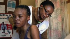 Lesotho, Scottova nemocnice. Spolupracovnice Lékařů bez hranic P. Lethola vyšetřuje pacientku s podezřením na TBC. &quot;Je velmi důležité, abychom ještě předtím, než zahájíme léčbu HIV antiretrovirovými léky zjistili, zda není pacient také nakažen TBC.&quot;