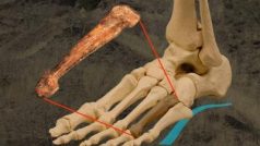 Perfektně zachovalá metatarzální kůstka druhu Australopithecus afarensis, která připojovala prst k bázi chodidla, byla nalezena v etiopském Hadaru
