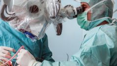 Liberecká nemocnice nakoupila přístroje za 21,7 milionu korun pro léčení cévních mozkových příhod i nádorových onemocnění