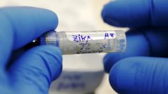 Zdravotnický úřad v Texasu oznámil přenos viru zika pohlavním stykem