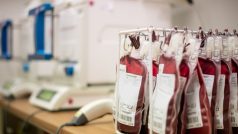 V Litomyšlské nemocnici provádí i klasické odběry plné krve. Plazma se může oddělit později