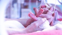 Předčasně narozené dítě v inkubátoru