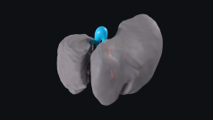 Model jater ve 3D vypadá jako šedá struktura, lékaři ho ale mohou řezat na části, orgánem procházet a souběžně s tím si ho zvětšovat nebo natáčet jakkoliv potřebují