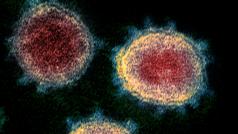 Koronavirus SARS-CoV-2 způsobující nemoc COVID-19 pod elektronovým mikroskopem na snímku z 13. února 2020 v r	NIAID Rocky Mountain Laboratories (RML) v USA.