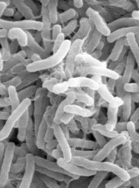 Bakterie cholery zobrazené elektronovým mikroskopem