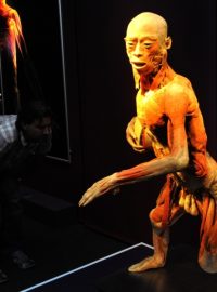 Výstava The Human Body Exhibition představí zhruba 200 exponátů z lidských těl či jejich částí zakonzervovaných pomocí plastinace