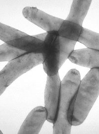 Bakterie Legionella pneumophila může způsobit legionelózu, akutní horečnaté onemocnění