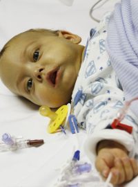 Lékaři v pražském IKEMu transplantovali malému pacientovi část jater od jeho otce