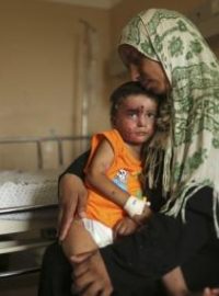 Palestinský chlapec, který byl zraněn v izraelsko-palestinském konfliktu. Ministr Lubomír Zaorálek plánuje v ČR léčbu zraněných dětí z Gazy