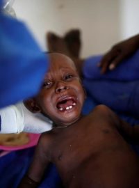 V nemocničním centru pro léčbu cholery na Haiti ošetřují dítě