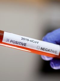Test na koronavirus (archivní foto)
