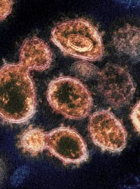 Nový koronavirus: snímek viru SARS-CoV-2, který způsobuje nemoc COVID-19, pod elektronovým mikroskopem. Výběžky na vnějším okraji vytvářejí podobu koróny či koruny, dle čehož se koronaviry označují. Fotografie od amerického úřadu National Institute of Health