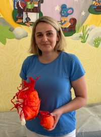 Lékaři z Fakultní nemocnice v Brně se na modelu vytištěném 3D tiskárnou připravili na operace cévních anomálií