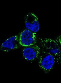 Fragmentace mitochondrií a jejich pohyb směrem k buněčné periferii