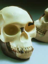 Rekonstrukce lebky tzv. piltdownského člověka. Hnědé plochy představují nalezené úlomky kostí