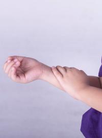 Takzvaná juvenilní idiopatická artritida projevuje nejčastěji mezi druhým a třetím rokem (ilustrační foto).