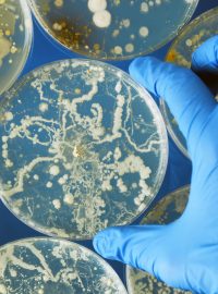 Bakterie rostoucí v Petriho misce (ilustrační foto)