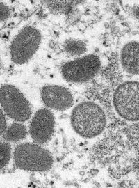 Virus opičích neštovic pod elektronovým mikroskopem